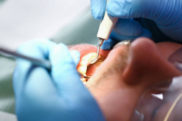 Best Emergency Dentist for Knocked-Out Tooth in Ridgely, MD
