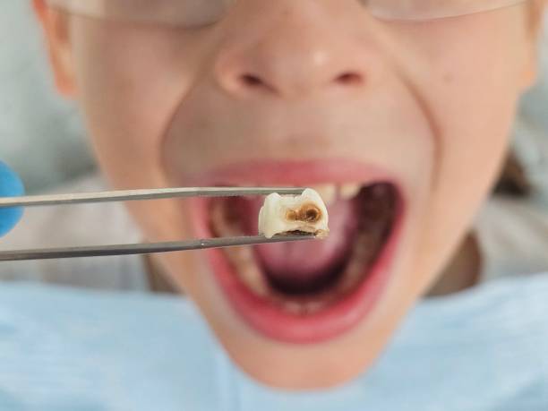 Best 24-Hour Emergency Dentist in Ridgely, MD